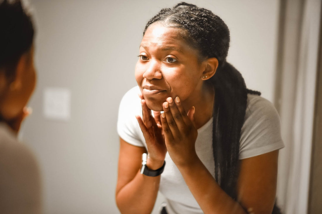 Peau noire acnéique : nos 3 astuces soin du visage - Ethnilink