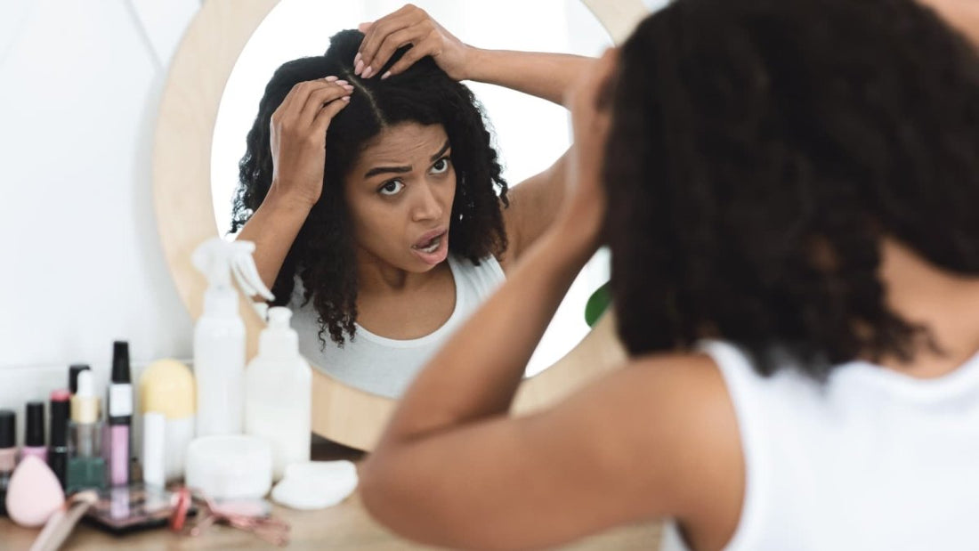 Démystifier les pellicules : causes courantes et conseils pratiques pour s'en débarrasser - Ethnilink